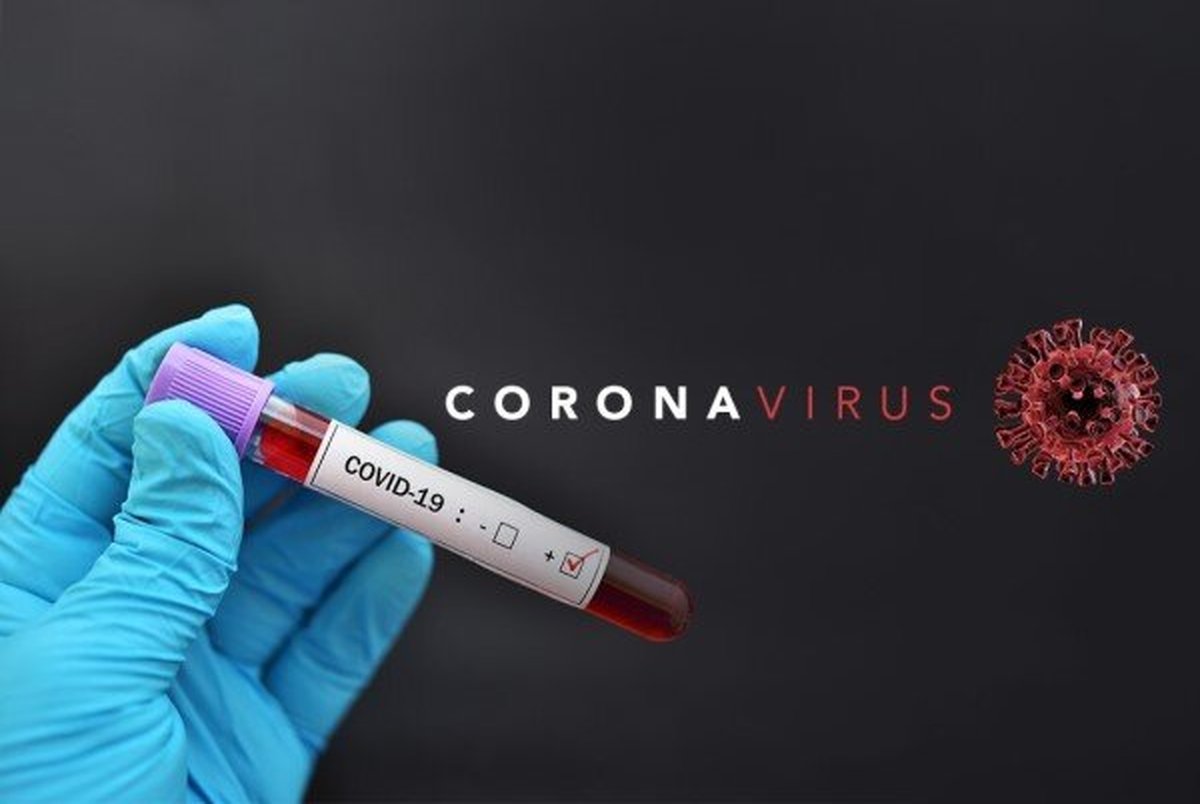  چرا کرونا ویروس به HIV شباهت دارد؟