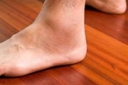 علائم ترومبوز هشداری درباره سلامت پاها