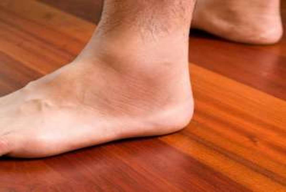 علائم ترومبوز هشداری درباره سلامت پاها