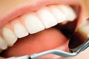نکات طلایی برای داشتن دندان‌های بی نقص
