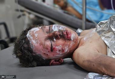 کشتار کودکان غزه توسط اسرائیل همزمان با تجاوز علیه ایران + عکس ها