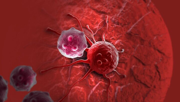 افزایش نگران‌کننده سرطان روده بزرگ در ایران