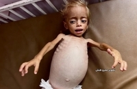 شام قدیح، کودک دو ساله فلسطینی (7)