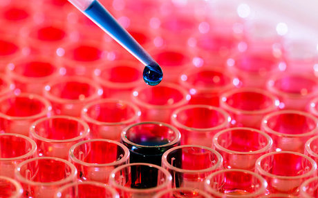 نکاتی درباره چگونگی تشخیص "لوسمی"
