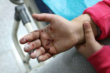 شمار مصدومان حوادث چهارشنبه سوری در قزوین به 27 تن رسید