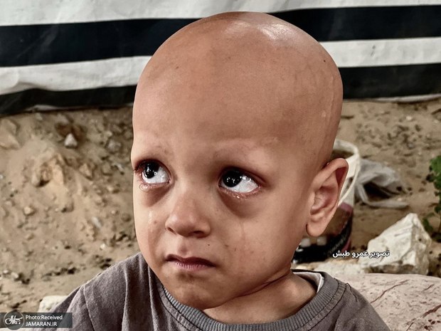 تصاویری دردناک/ فریاد گرسنگی در چشمان یک کودک؛ عبدالله ابو زرقة، تصویری از رنج بی‌پایان غزه