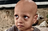  فریاد گرسنگی در چشمان یک کودک (9)