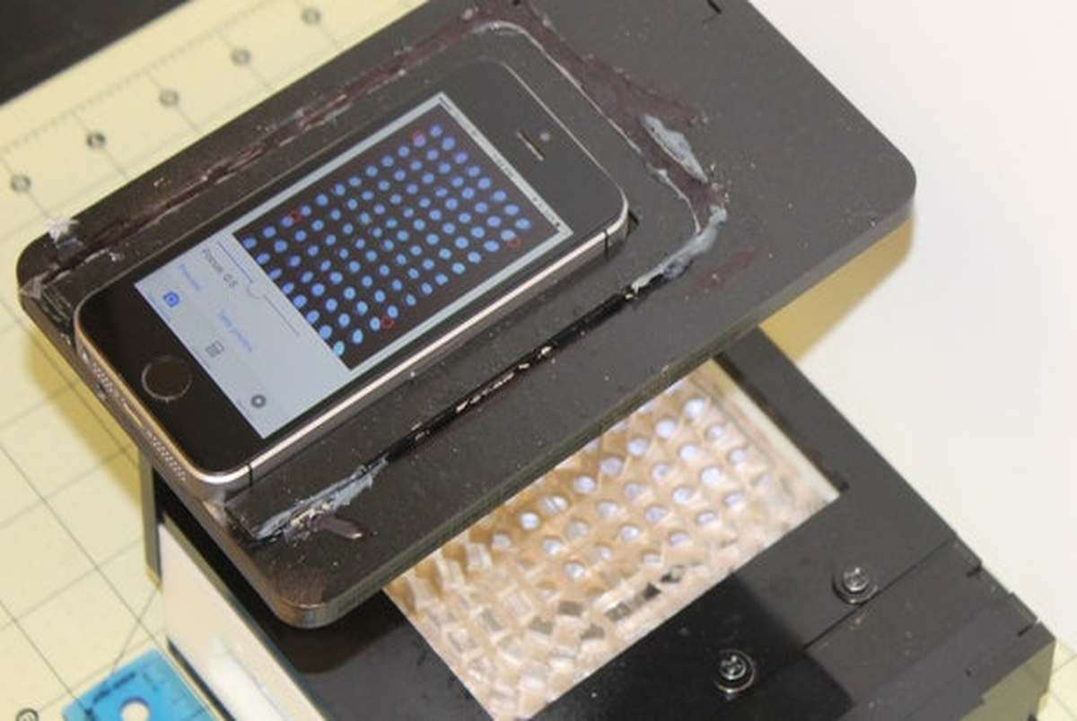 دستگاهی که بیماری شما را با تلفن همراهتان تشخیص می دهد 