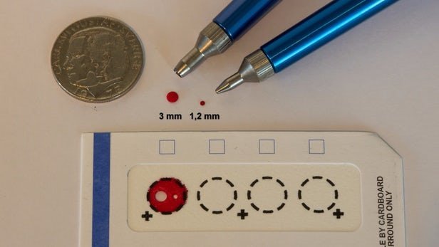 نمونه‌های خون خشک جایگزینی مناسب برای خون مایع


