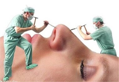 افزایش شکایات از جراحی‌های زیبایی
