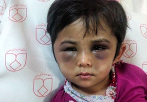 ضرب و شتم کودک 4 ساله توسط برادرش  نامشخص بودن هویت کودک اصفهانی