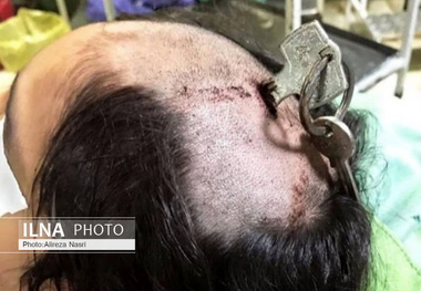 حادثه کودک آزاری در قزوین  فرو بردن کلید منزل در سر کودک توسط مادرش 
واکنش معاون سیاسی استاندار