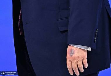 وضعیت دست ترامپ بدتر شد + عکس ها