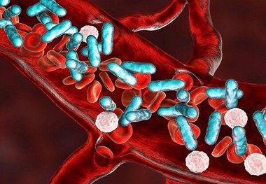 خطر سپسیس با دیابت نوع ۲ دو برابر می‌شود
