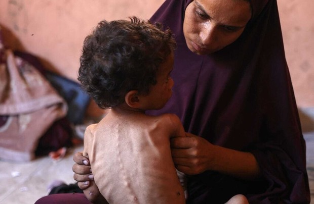 شیوع یک بیماری همه گیر جدید در غزه: ویروسی مرگبار شبیه کرونا جان کودکان گرسنه را می گیرد