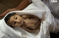 تشییع پیکر نوزاد شهید بر اثر قحطی در خان‌یونس (3)